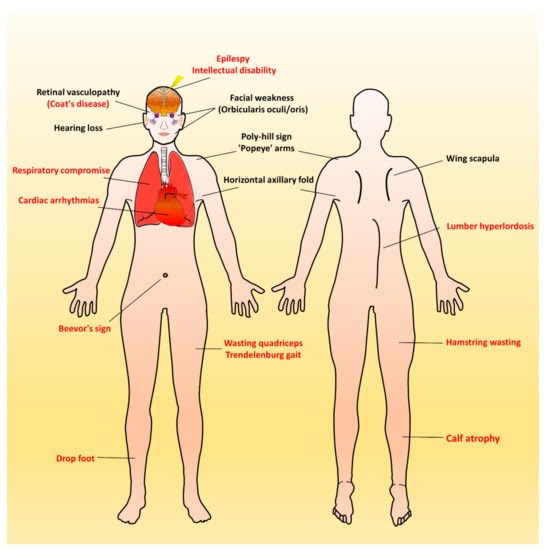 I. Identify The Main Muscles Of The Body, Using The ...