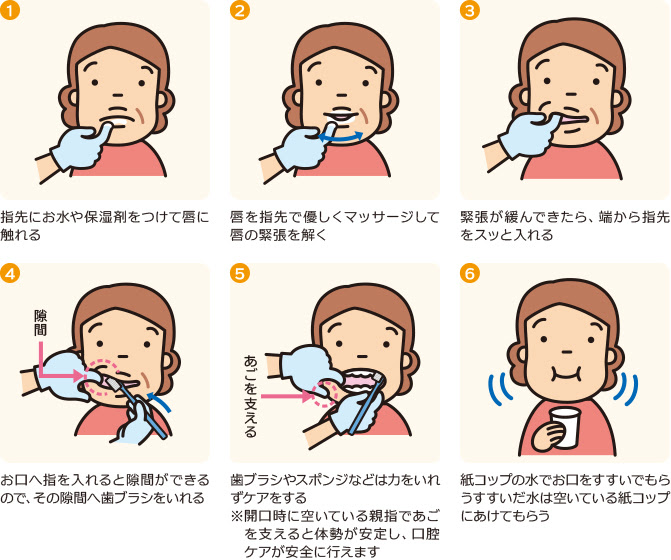 ベスト50 口腔 ケア 手順 イラスト スーパーイラストコレクション