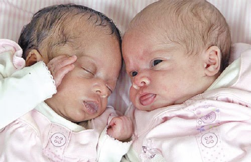 Unik : Bayi Kembar Hitam Putih (2 Gambar)  Aku Stress Giler
