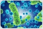 Technology Advances in Bacteria Detection