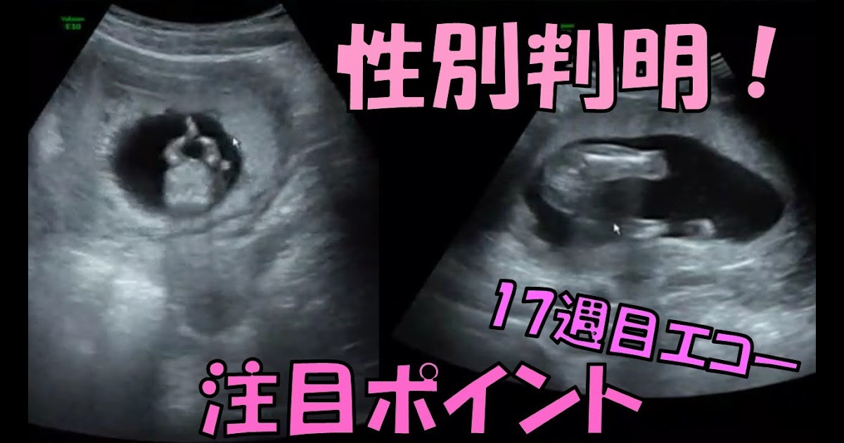 週 性別 男の子 エコー 週 性別 男の子 エコー Mbaheblogjpfvk0