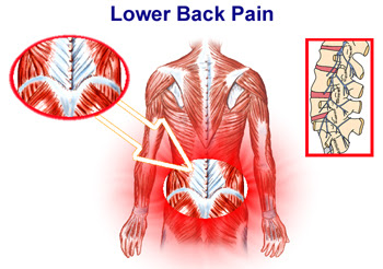 736 x 736 jpeg 76 кб. Premier Health Center P C Low Back Pain In City