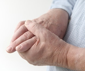 OSA patients have higher risk of developing gout, research reveals