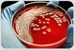 Study shows genetic mutations allow MRSA to develop antibiotic resistance