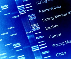 Study sheds light on the genetic causes of tumors in salivary glands