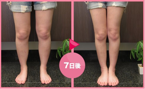 Testter ふくらはぎ 筋肉 落とす 注射