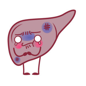 What Is Liver Steatosis Or Fatty Liver Disease Causes And Evolution