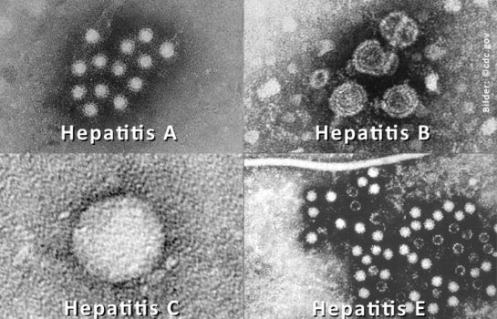 Acute hepatitis can resolve on its own,. Startseite Welt Hepatitis Tag