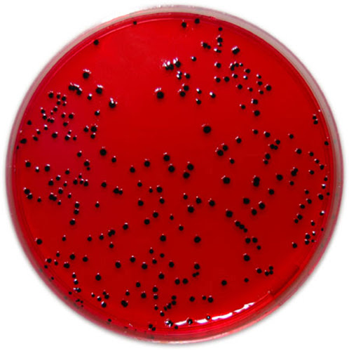 Resultado de imagen para salmonella agar xld