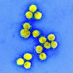 Courtesy of NIAID. Transmission electron micrograph of SARS-CoV-2 virus particles, isolated from a patient.