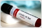 New blood test for antibodies in COVID-19 infected