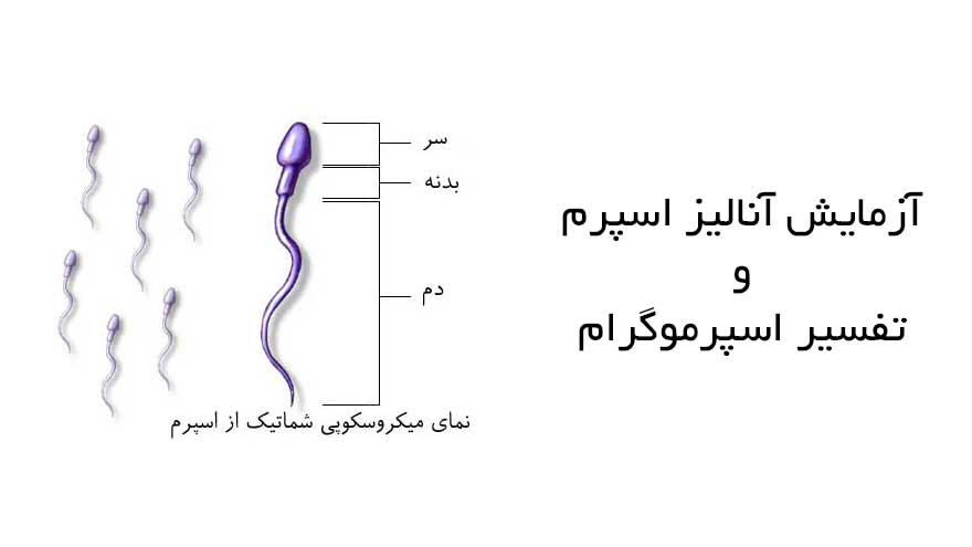 Menstrual disorder, priapism, retrograde ejaculation, sexual dysfunction, vaginal discharge. ØªÙØ³ÙŠØ± Ù¾Ø§Ø±Ø§Ù…ØªØ±Ù‡Ø§ÙŠ Ø¢Ø²Ù…Ø§ÙŠØ´ Ø§Ø³Ù¾Ø±Ù…ÙˆÚ¯Ø±Ø§Ù…