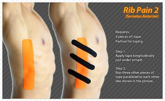Physical Therapy Exercises For Broken Ribs Exercise Poster