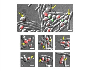 Insights into parasitic yeast species could lead to new strategies for controlling yeast pathogens