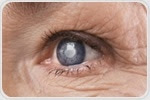 NEI researchers link age-related DNA modifications to susceptibility to eye disease