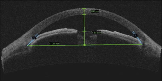 Mesvision focuses on brilliant vision care and a healthy lifestyle. Vision Insurance Hmsa Ohana Health Medicare Uha Hmaa Va Drs Lee Leong