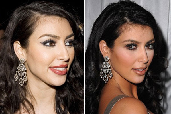 How many kim kardashian plastic surgery procedures were there? Before And After Surgery Or Not Kim Kardashian Pictures Photos And Images For Facebook Tumblr Pinterest And Twitter