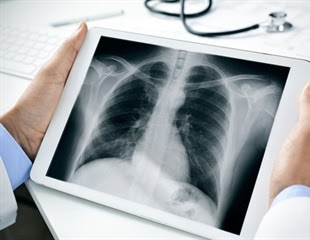 Digital Radiography