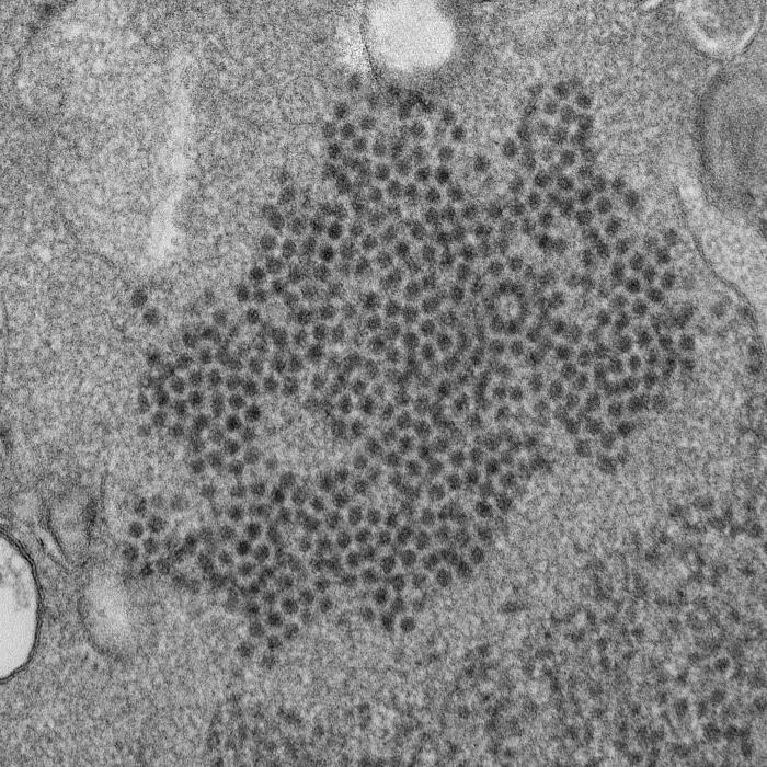 enterovirus D68 particles