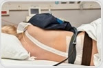 Epidural for Labor Pain