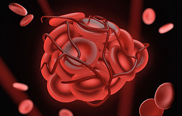 An illustration of a blood clot.