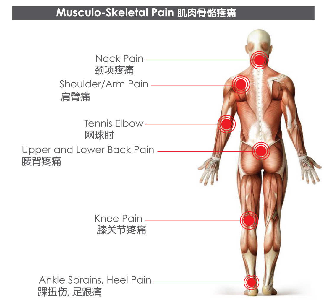 Treatment may include physical therapy, medications, cortisone injections, and sometimes for most common types of back pain, steroid medications have not been shown to be beneficial. Common Ailments Econ Chinese Medicine