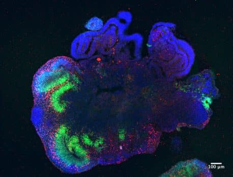 Cerebral organoids. Three-dimensional "mini-brains" have been produced lfrom human embryonic stem cells, later comparing their functionality