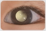 Novel detection method for retinoblastoma