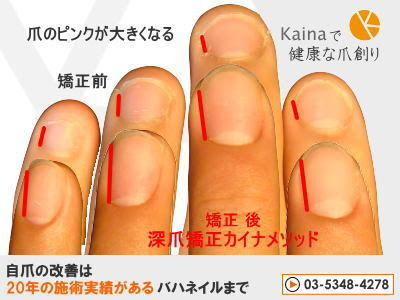 これまでで最高の爪 ピンク 伸ばす 方法 最高の花の画像