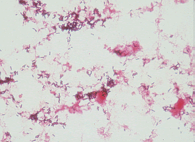 Listeria monocytogenes is the species of pathogenic bacteria that causes the infection listeriosis. Listeria