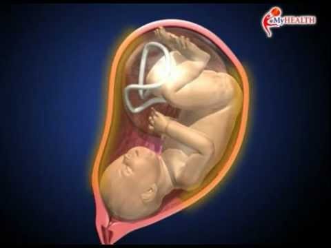 Video : Kaedah / Cara Melahirkan Bayi ~ [AzlanLin] EDU3102 