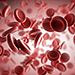 Underuse of Blood-Thinning Medication Ups Stroke Risk