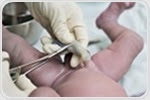 Umbilical cord blood safely and effectively treats children with rare genetic disorders