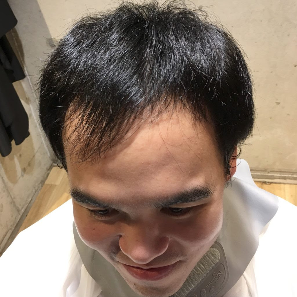 最も人気のある髪型 エレガント薄毛 目立たない 髪型 男性
