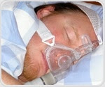 Loyola Medicine otolaryngologist corrects sleep apnea symptoms with ENT procedure