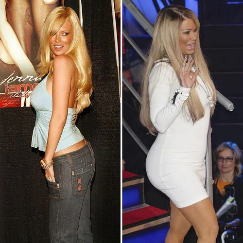 Celebrity booty implants â€“ look at these shocking photos! â€“ HOT NEWS