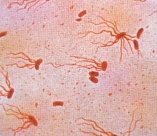 Morphology Culture Characteristics Of Salmonella Typhi S Typhi