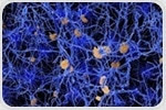 Viewpoint: Could infectious pathogens play a role in Alzheimer's disease?