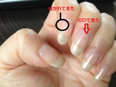 立派な ジェル ネイル 伸び すぎ 画像ブログ
