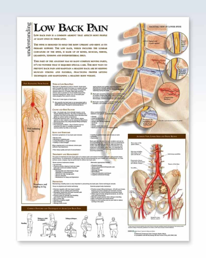 Use your painspot results to help you and your doctor get to the bottom of your pain. Low Back Pain Exam Room Human Anatomy Posters Clinicalposters