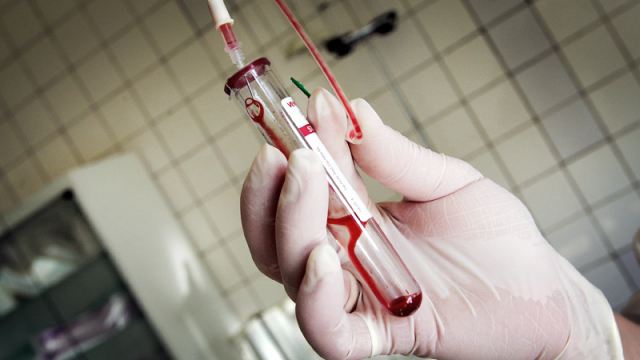  Conversation: HIV Compounds Russia's Demographic Problems