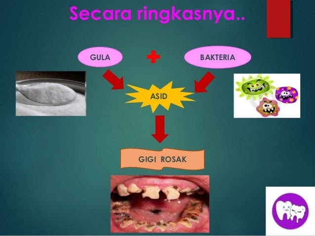 Ubat Surut Bengkak Gusi Di Farmasi - Berubat g