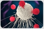 CAR T cell therapy can predict treatment outcomes in patients with large B-cell lymphoma