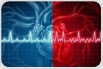 AI helps detect atrial fibrillation cheaply and reliably