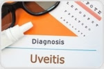 Researchers find a class of drug that could be promising treatment for uveitis