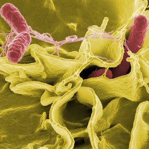 Bacteria in gut