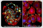 Tips for Successful Immunofluorescence in Cultured Cells