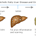 Poop Fatty Liver Stool Color