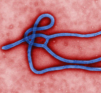 Ebola.  Image courtesy of the CDC Public Health Image Library.