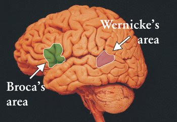 Broca's and Wernicke's Areas of the Brain